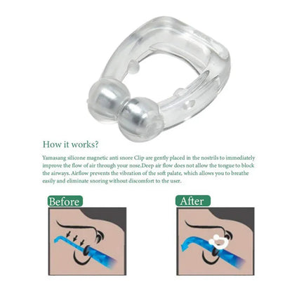 Magnetic Anti-Snore Ring – Silicone Aid for Easy Breathing